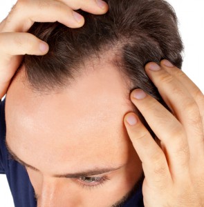 Haarausfall ist ein weitverbreitetes Thema